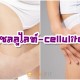 เซลลูไลท์-cellulite