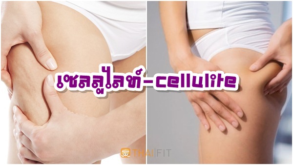 เซลลูไลท์-cellulite