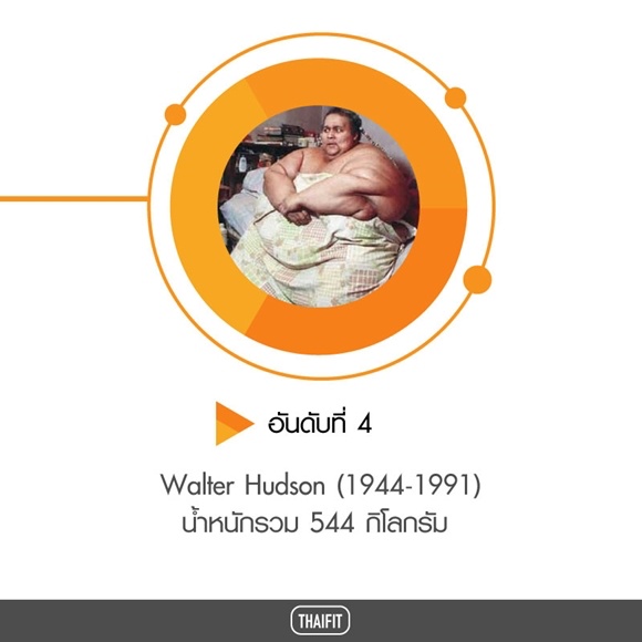 4. Walter Hudson (1944-1991) รักษา โรคอ้วน